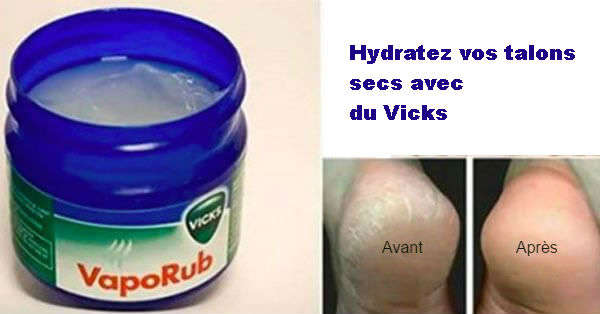 " Trucs et Astuces en tout genre " Maria-Lys Vaporub-talon-sec-hydrates