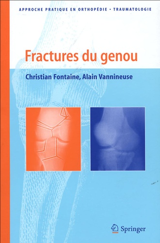 Fractures du genou 9782287597329FS