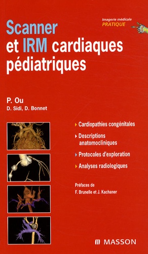 Scanner et IRM cardiaques pédiatriques édition Masson en Exclusivité pour Pédiatrie-DZ 9782294074653FS