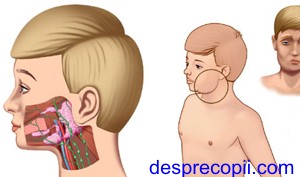 Oreionul la copil Oreion2