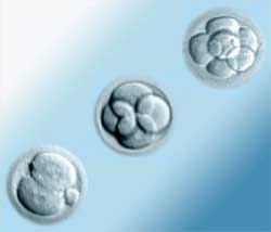 Embrio transfer- implantacija (usadjivanje) i materica Chapter25c1