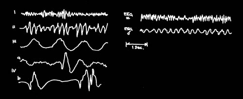 Alerta : La Electricidad Cerebral en Peligro - LA RESONANCIA SCHUMANN . - Página 6 Resonance