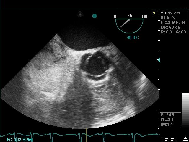 Hypoxmie Contraste%20eto%20negatif