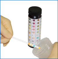 شرائط الغمس Urine strips Urine_strips