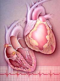 Maladies cardiaques  Coeur_04_rythme