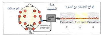 الصرع و التخطيط الكهربي للدماغ EEg%20(1)