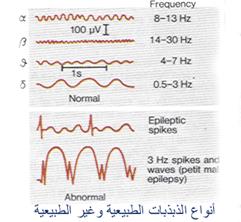 الصرع و الرسم الكهربي للدماغ e.e.g  EEg%20(2)