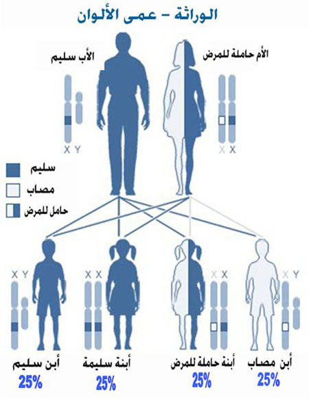 علاج جديد لمرضى عمى الألوان Color_Blindness%20%283%29