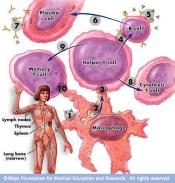  التهاب الجلد والعضلات Dermatomyositis%20%281%29