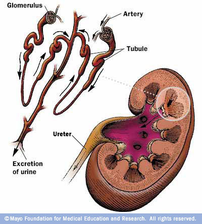 المتلازمات Syndromes -موضوع شامل  Nephrotic_Syndrome%20%285%29