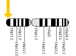 المتلازمات Syndromes -موضوع شامل  Rubinstein-Taybi%20%281%29