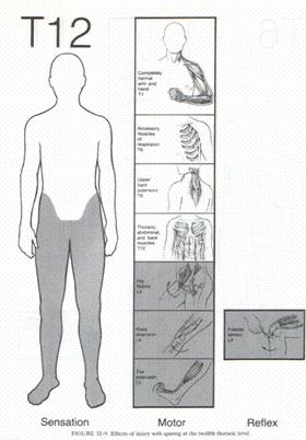 التأهيل الحركي لإصابات النخاع الشوكي Taheel%20%286%29