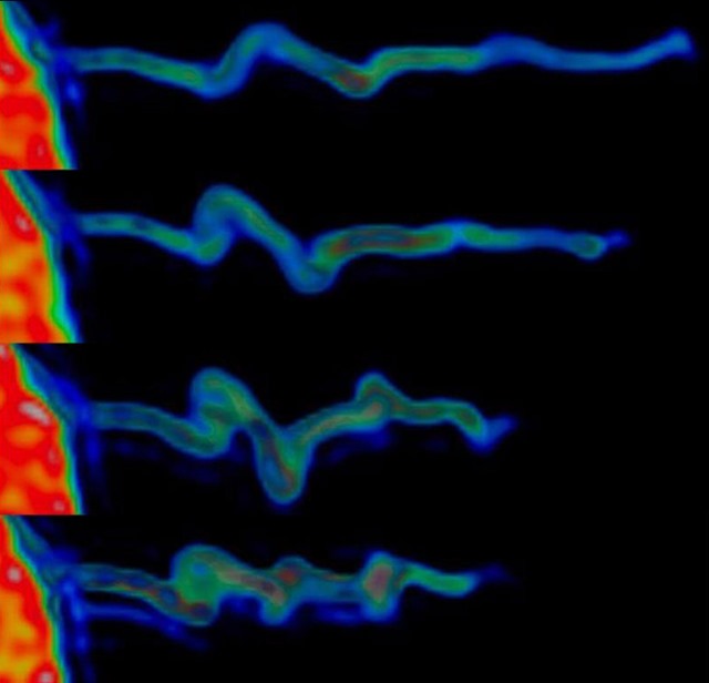 Au niveau moléculaire, l’impressionnante vidéo du processus de mémorisation en action Filipodes-cellule_thumb