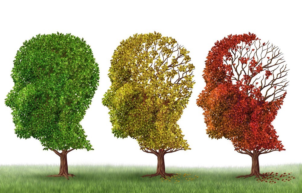Un nouveau médicament inverse de 3 manières différentes les symptômes de la maladie d’Alzheimer… chez des souris ! By Gurumed.org Alzheimers-18_thumb