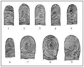 COMPOSITES (Loops / Whorls): Central Pockets, Lateral Pockets, Twin Loops & Accidentals Purkinje