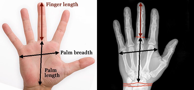 6 Hand signs for Extraversion / Introversion! - Page 2 Finger-length-measurement-x-ray-hand