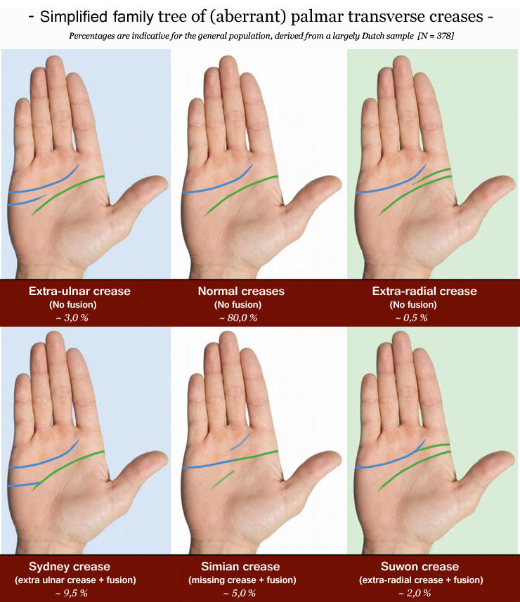 Suwon line? Simian-line-sydney-line-suwon-crease-extended-heart-line