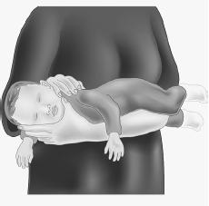 Colic المغص عند الطفل الرضيع  114981