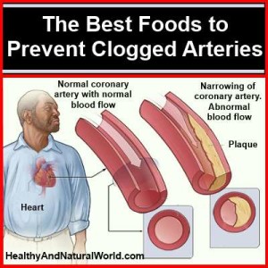 The Best Foods to Prevent Clogged Arteries Post2291-300x300