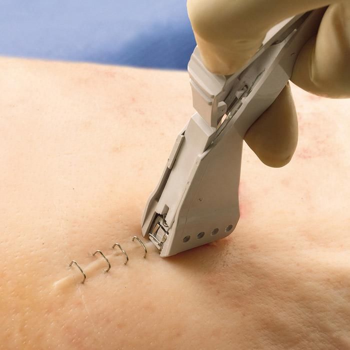 Point de suture Agrafeuse-cutanee-a-usage-unique-3m-precise-1214681