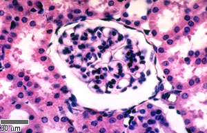 HISTOLOGIA DEL SISTEMA URINARIO RenalCorpuscle_E1