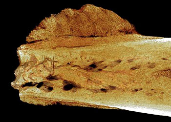 Un cancer enfin diagnostiqué 1,7 millions d’années après Cancer-os-swartkrans-vue-3d-interieur