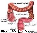  فحص القولون بالمنظار بعد الخمسين قد ينقذ حياتك‎ 1243595858