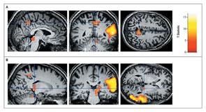 QUE SE PASSE-T-IL À LA MORT ?  Dans certains cas le Christ, vient Lui-même au lit de mort pour accueillir son serviteur... - Page 2 IRMF%20NEJM2