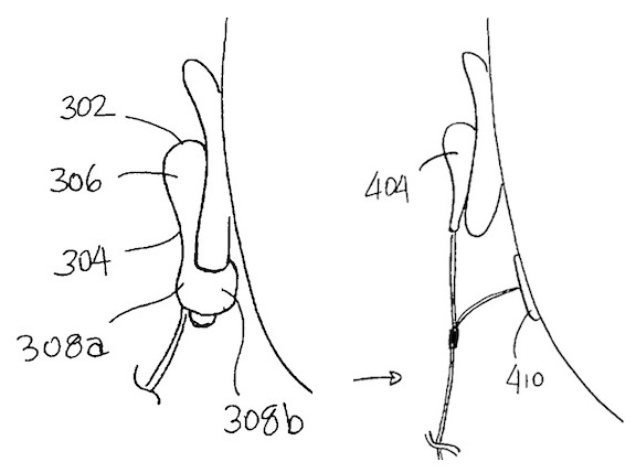 Crazy Rumor: New Apple EarPods will come with Heart Rate and Blood Pressure sensors, extra mic for B Apple_headphone_sensors