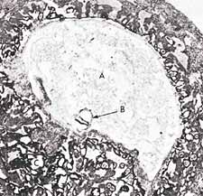 A) The Quran on Human Embryonic Development: Ch1-1-a-img3