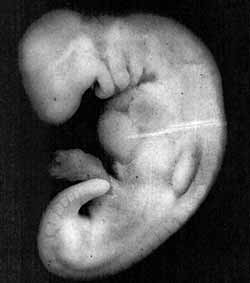 The Quran on Human Embryonic Development مراحل تطور الجنين في القرآن  Ch1-1-a-img5