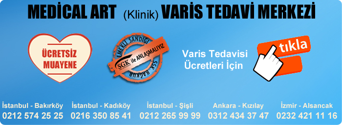 istanbulvaris.com | En iyi Varis Tedavi Adresi Varis-tedavi-fiyatlari-2015