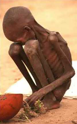 Historielös höger....igen - Sida 4 Starving_child-sudan2