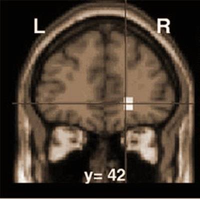 تأملات في الاعجاز العلمي في القرآن والسنة .. ( كل يوم اعجاز ) 2154_brain