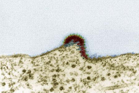 صورة حقيقية لفيروس الإيدز°°جندي مطيع للرحمن سلطه على من تعدى حدوده°° Aids-hiv-2