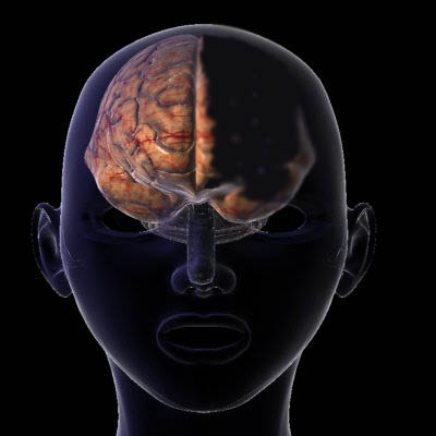 امرأة_ تعيش_ بنصف _دماغ Brain2454