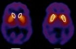 Male is not like female: a new scientific vision Brain_male_female_00