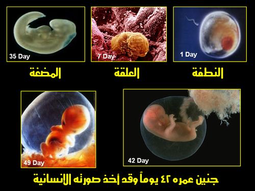  أروع صور للجنين Embryo_human_001
