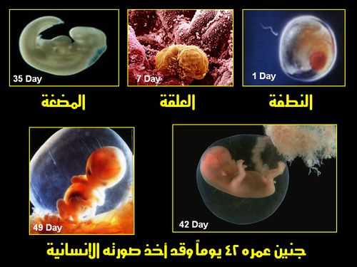 ๑ஐ◄▓▒-->فـليـنظـر الإنـســان مِــمَّ خُـلِـق <--▒▓►ஐ๑ Embryo_human_001