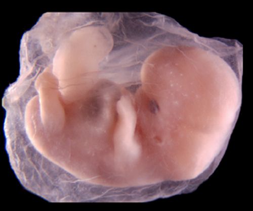 إذا مرَّ بالنطفة ثنتان وأربعون ليلة.. معجزة نبوية ترد على الملحدين  Embryo_human_003