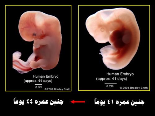 إذا مرَّ بالنطفة ثنتان وأربعون ليلة.. معجزة نبوية ترد على الملحدين  Embryo_human_006