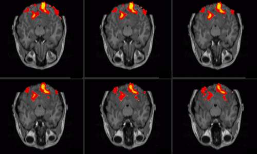 الاعجاز فى النفس.الانسان الكائن العجيب .الجزء الثالث FMRI_frontal_brain04