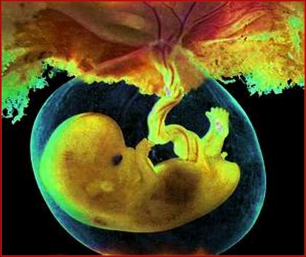 ايات الله في الكون للشيخ محمد حسان  Picture_embryo_8