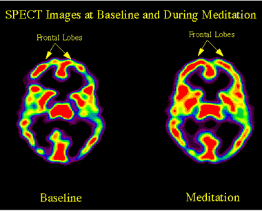 أسرار الشفاء بالصلاة Prayer-brain-active-01