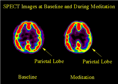 أسرار الشفاء بالصلاة: ملف شامل Prayer-brain-active-02