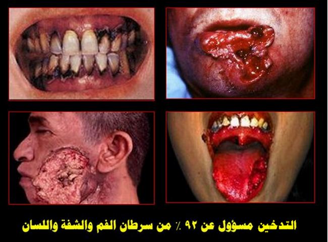 صور لمدمنين التدخين Smoking-harmful-021