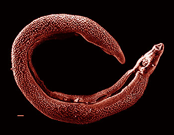 Dinesat 9 Full + Crack - Página 3 Schistosoma