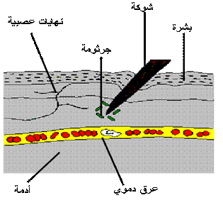 لكل من يواجه مشاكل في دروس المناعة Immuno1