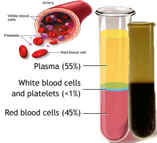 هل يجوز التداوي بالكي ؟ Plasma