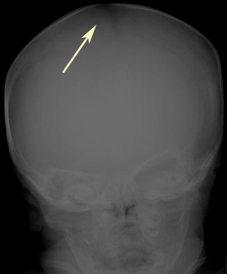 كتاب رائع عن "الحجامة ، الفصد ، الكـي" - صفحة 2 Xray